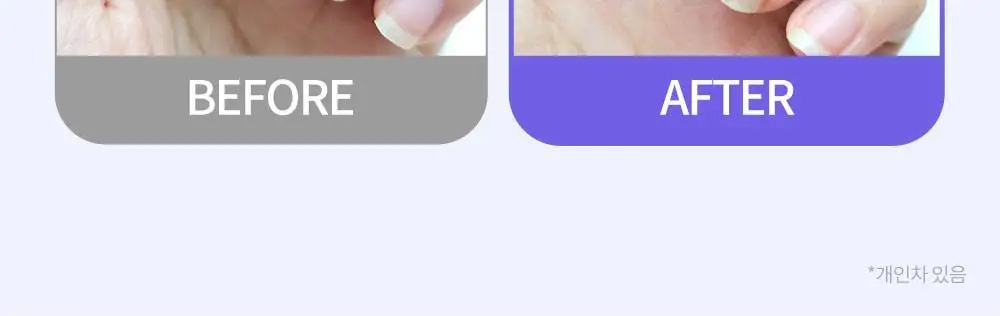 [큐티클간편케어] 코스노리 실크리페어 네일 크림 손톱영양제 상세페이지 11
